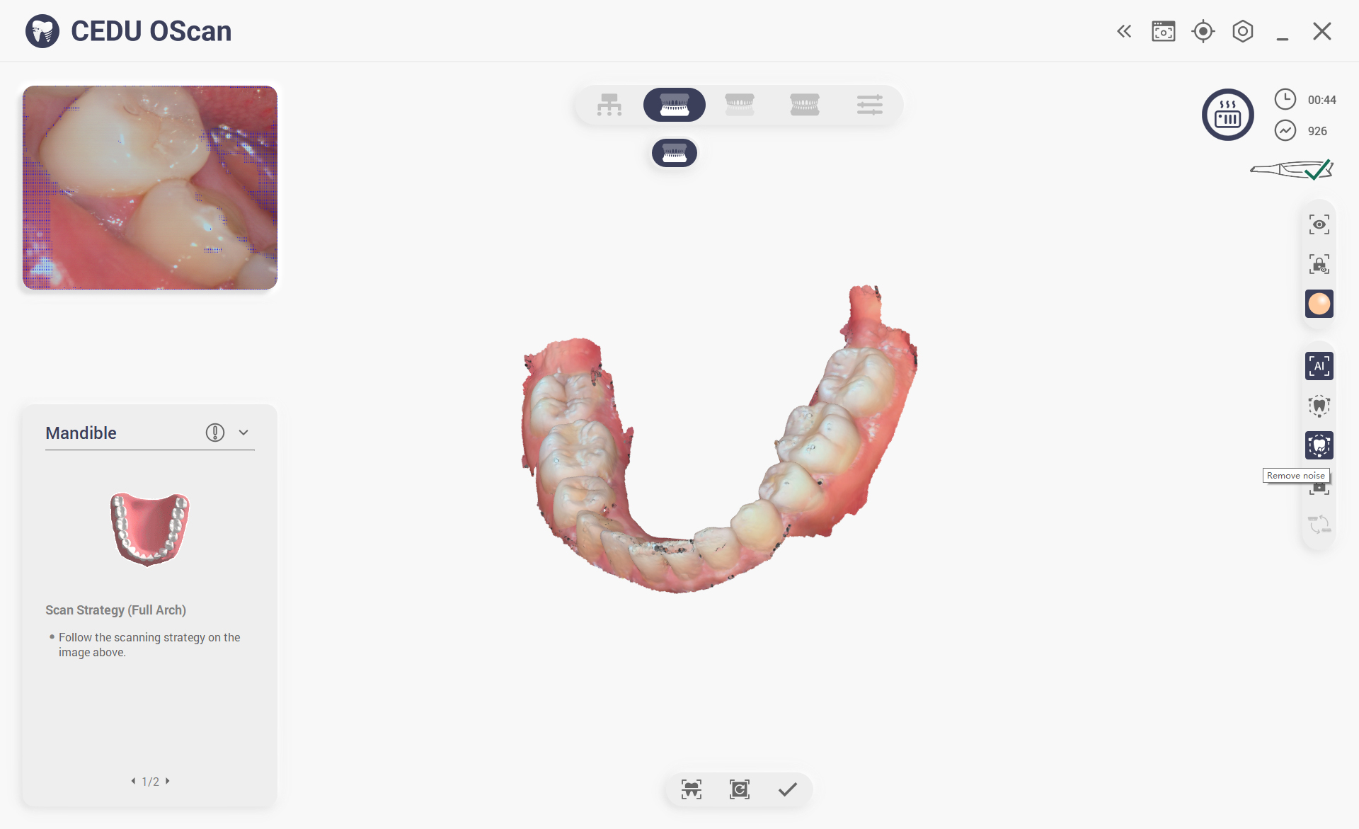 intra Oral scann – Intra Oral Scanner, Milling Machine, Zirconia Blocks ...